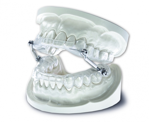 Zahnwandel - Schnarchtherapie
