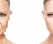 Beauty Skin Cologne - ULTRA (-SCHÖN -SCHNELL) ULTRASCHALL - Deluxe Behandlung Thumbnail