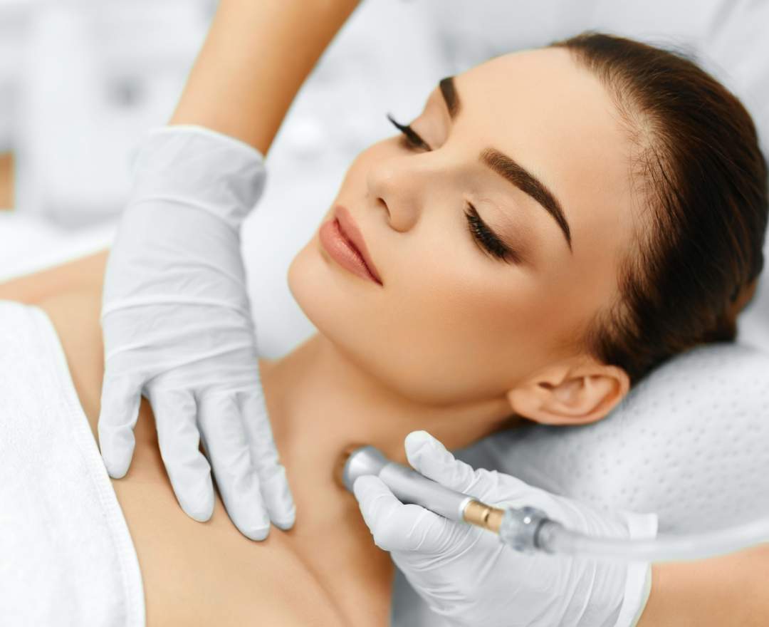  - Microdermabrasion