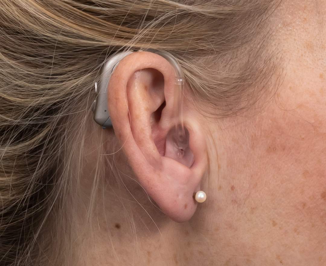 VITT HÖRAKUSTIK - Hörsystem Hinter-dem-Ohr (HdO)
