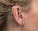 VITT HÖRAKUSTIK - Hörsystem Hinter-dem-Ohr (HdO) Thumbnail