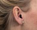 VITT HÖRAKUSTIK - Hörsystem In-dem-Ohr (IdO) Thumbnail