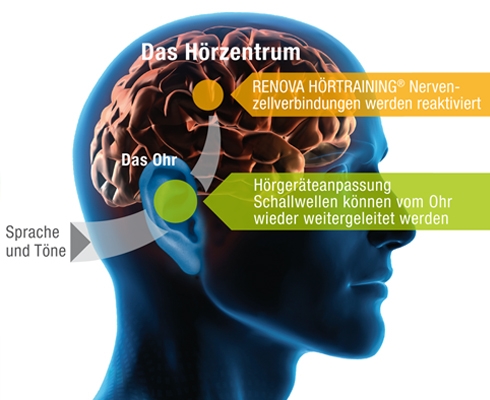 RENOVA - HÖRTRAINING®