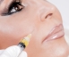 Stylage & Teosyal - Lippen aufspritzen & Faltenunterspritzung mit Hyaluronsäure  Thumbnail