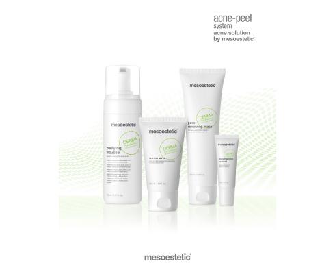 Mesoestetic acne-peel system