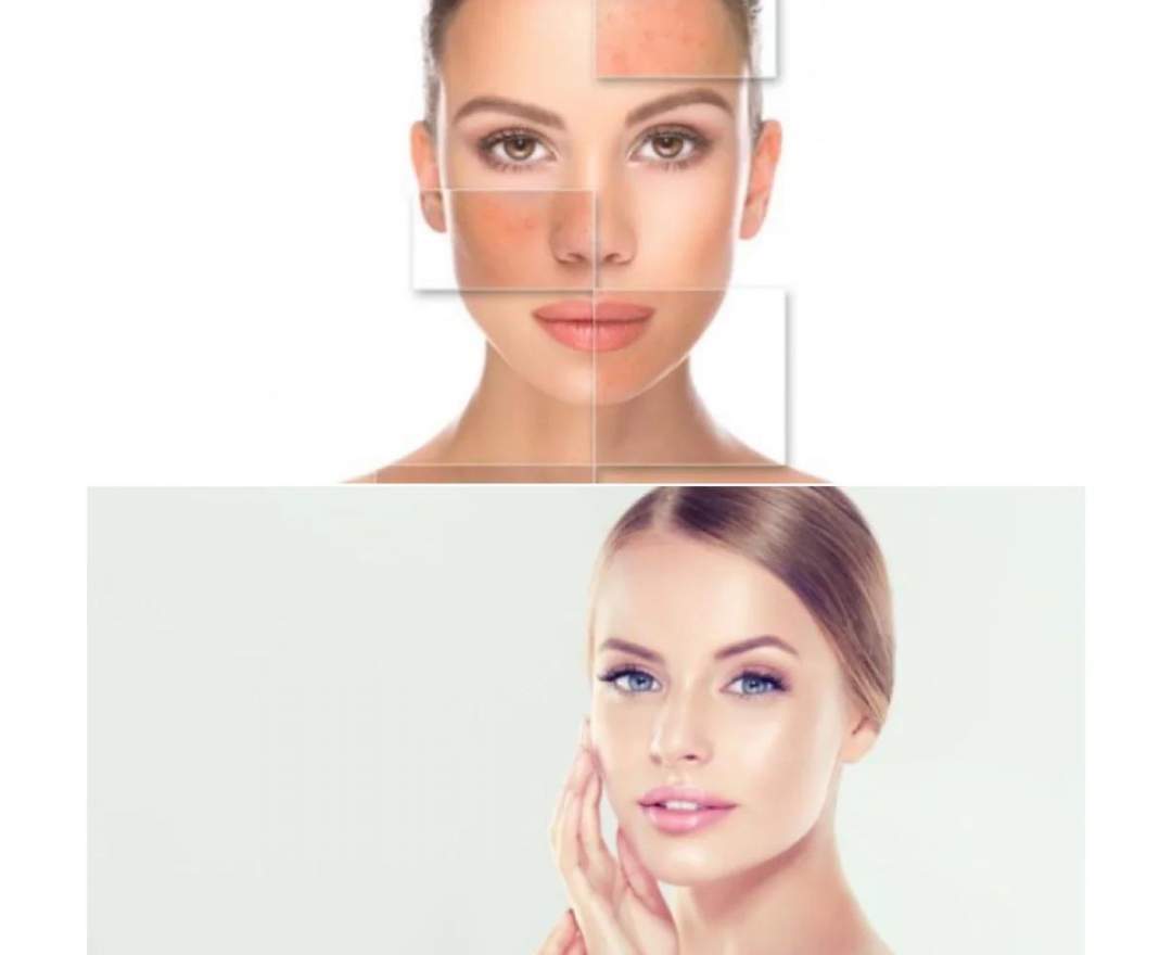 Zeitguthaben Kosmetik & Mehr - SKIN CORRECTION SYSTEM® für den ultimativen Glow