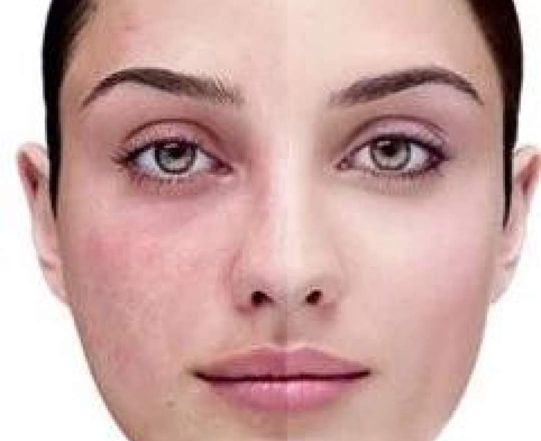 Zeitguthaben Kosmetik & Mehr Microneedling