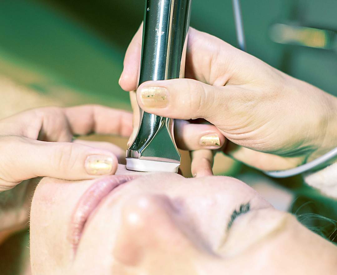 Dermapen MEDIZINISCHES NEEDLING