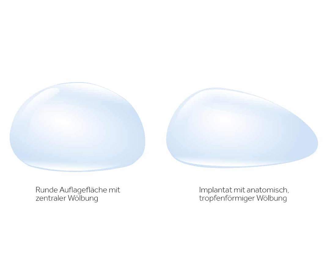 Kanesthetic – Breast & Beauty - Brustvergrößerung