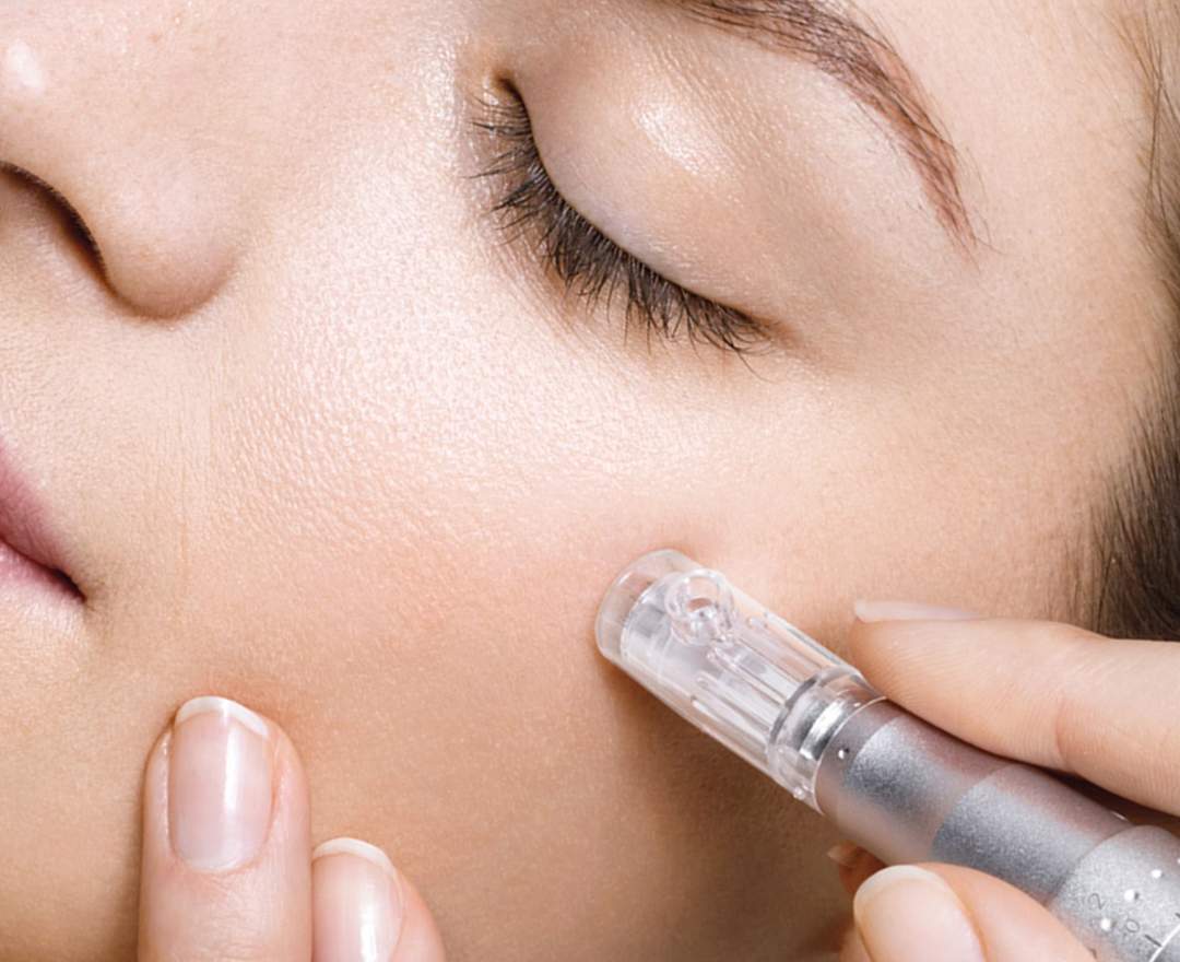 BABOR - Apparative Kosmetik 'Micro-Needling' Behandlung