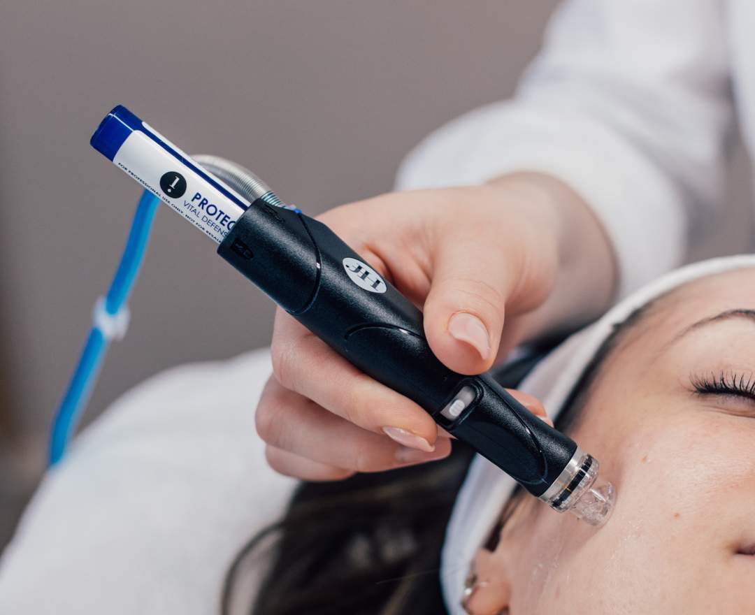 HydraFacial - HydraFacial SYNDEO - DELUXE