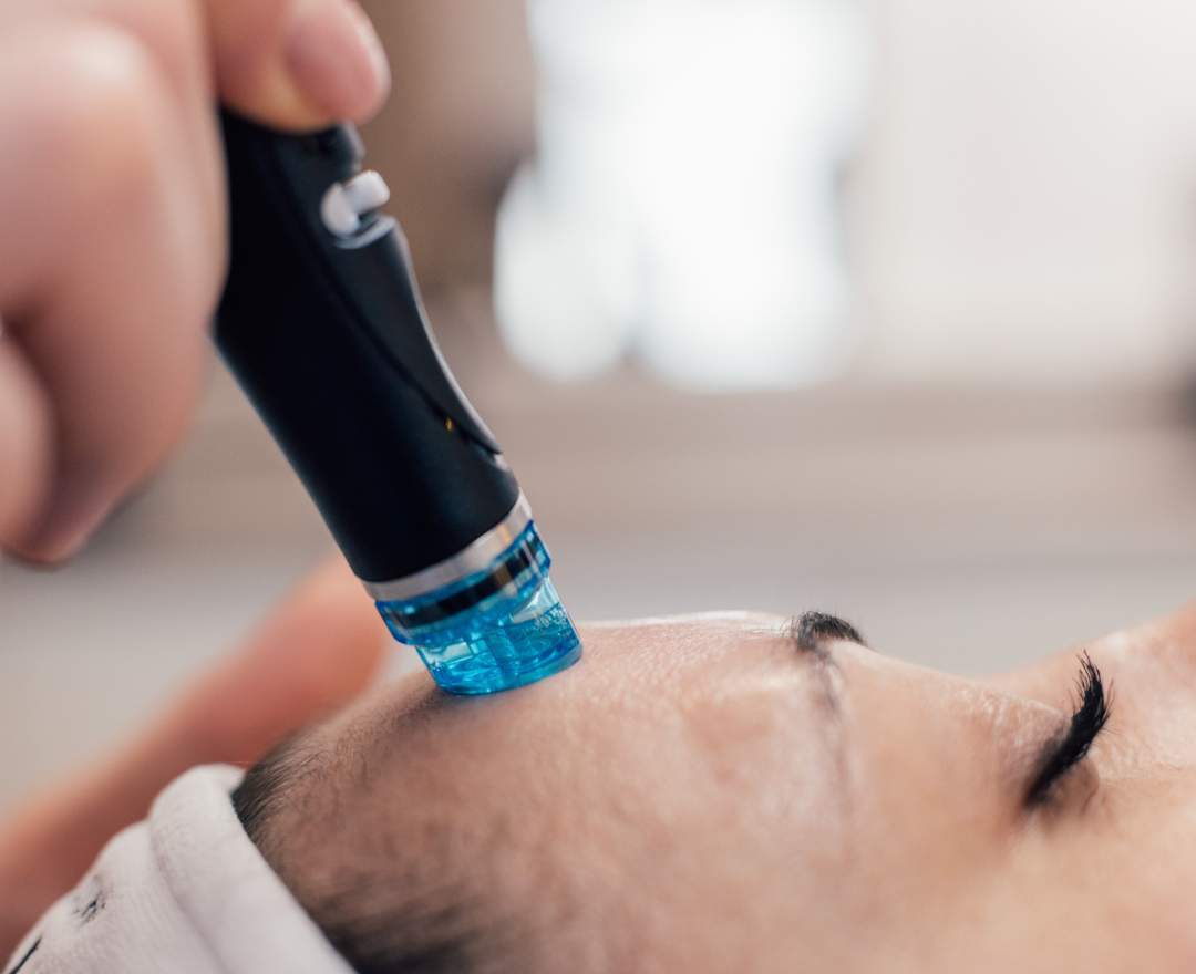 HydraFacial - HydraFacial SYNDEO - DELUXE