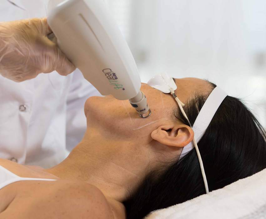 Swiss Derma Clinic Pixel CO2 Laser