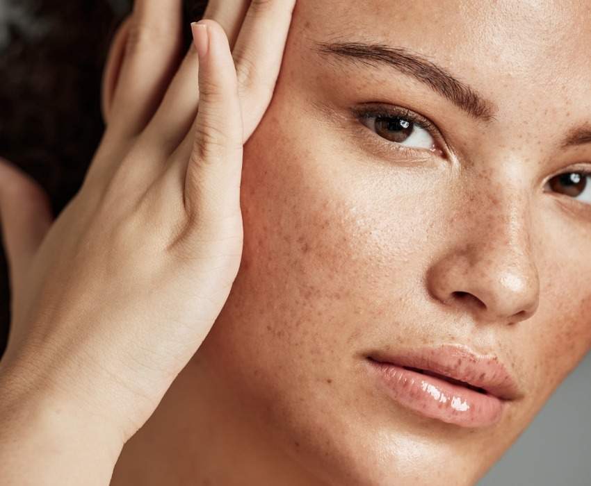 Swiss Derma Clinic Krähenfüße entfernen