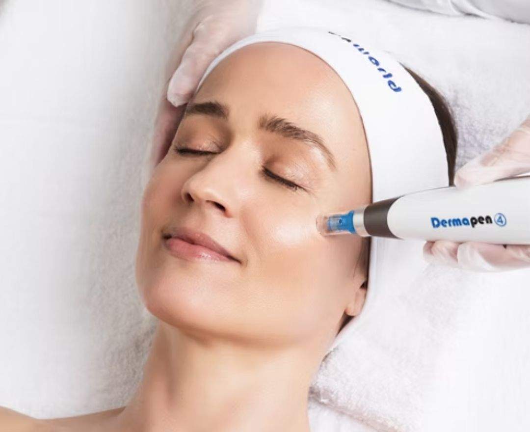 Reviderm REVIDERM Microdermabrasion – Hauterneuerung auf höchstem Niveau