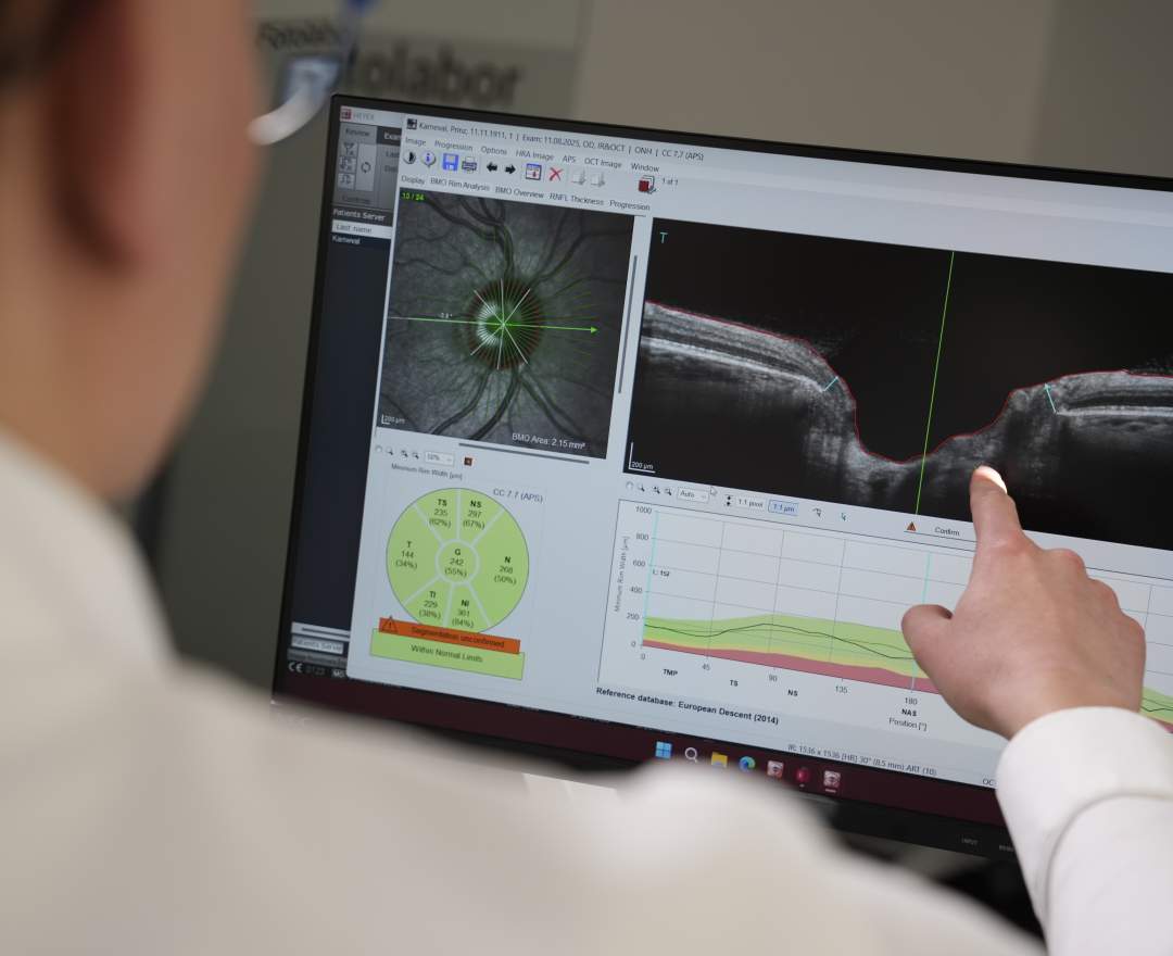 Clear Vision Cologne - Augencheck-up in Köln