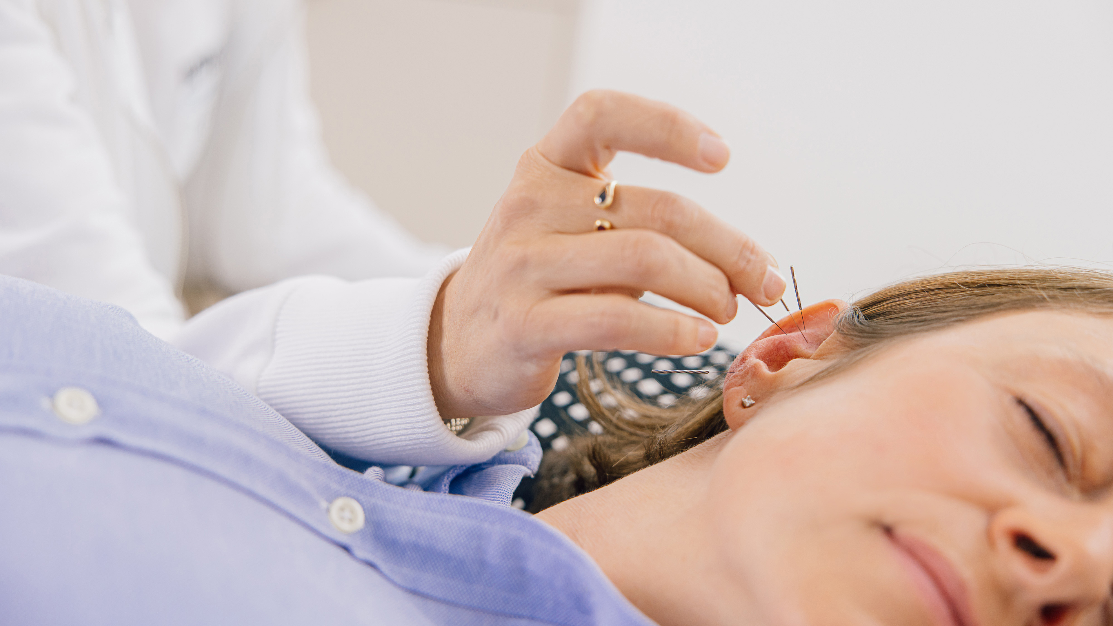 Nahaufnahme einer Behandlung mit feinen Nadeln im Rahmen einer Schmerztherapie