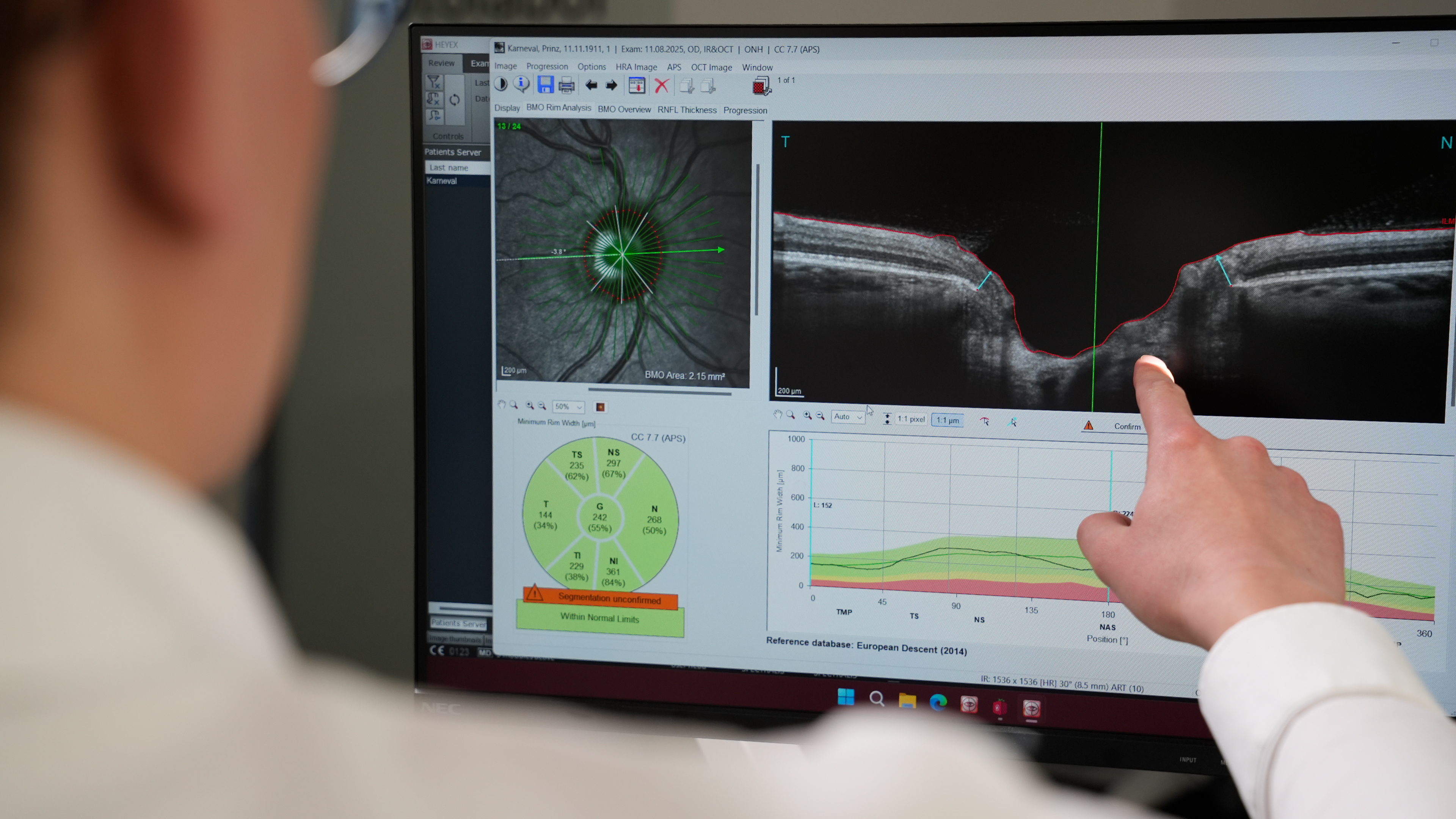 Ergebnis des Augen-Check-ups