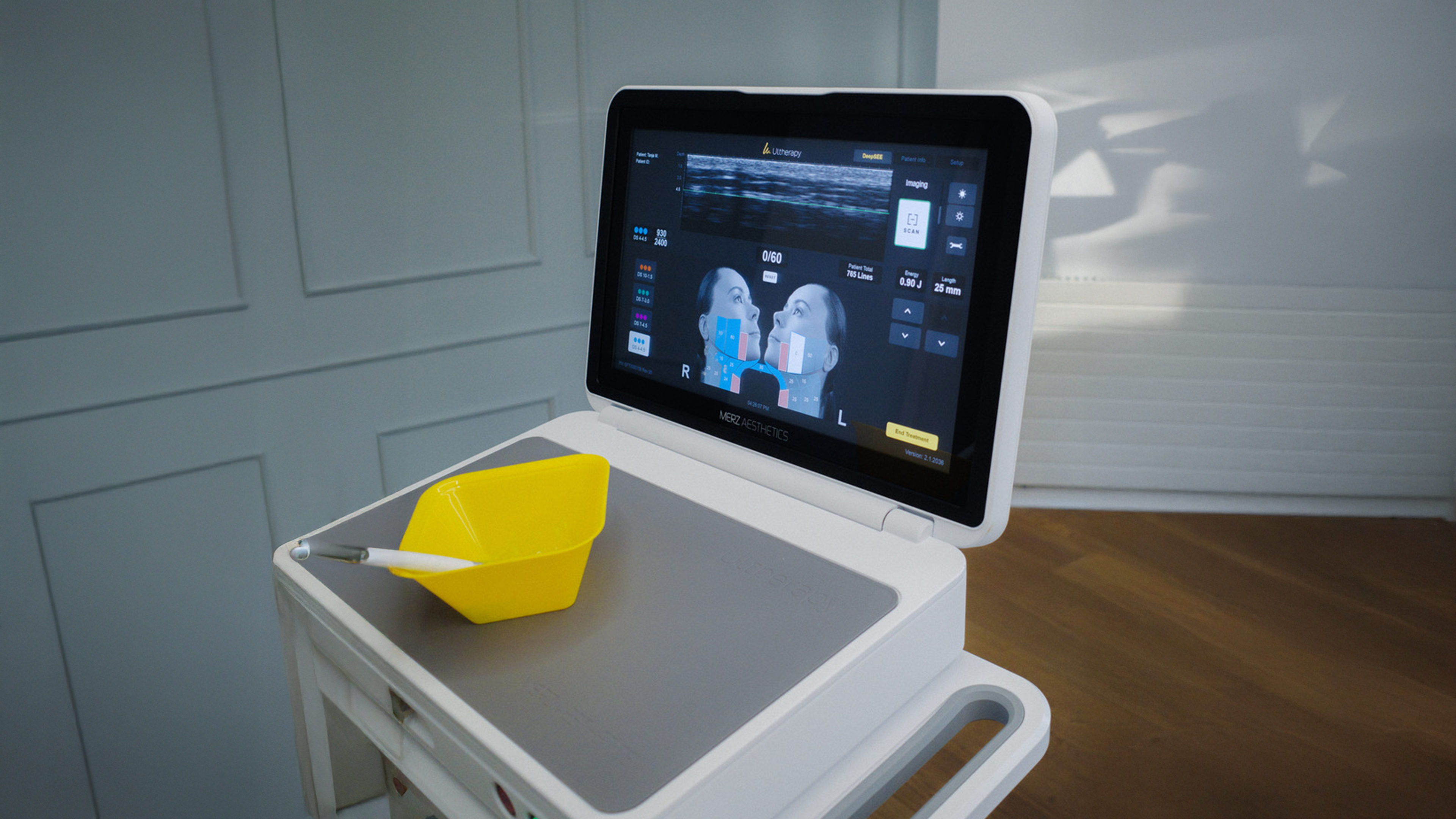 Ultherapy Prime Ger&auml;t